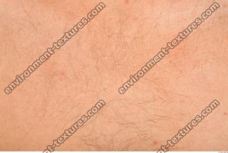 human skin hairy 0011